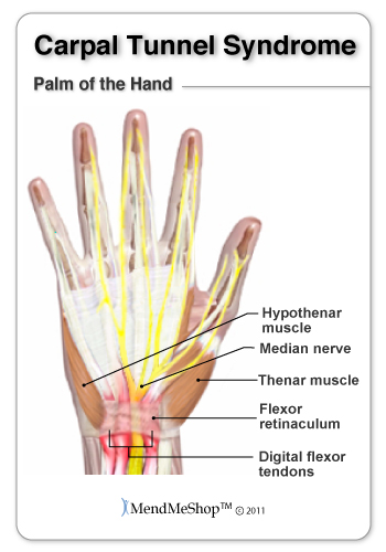 What are some causes of a lump in your wrist below your thumb?
