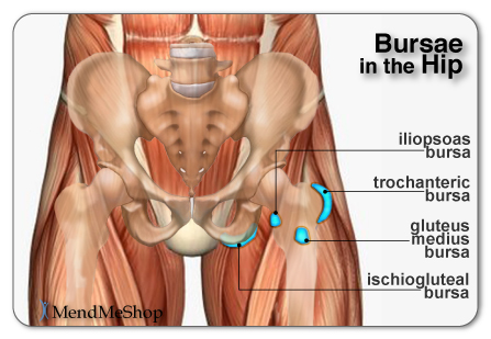 Hip anatomy showing the iliopsoas, trochanteric, gluteus medium and ischiogluteal bursae 
